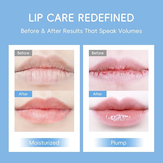 AKARY Milk 5 Pcs Moisturizing Lip Mask, Lip Sleep Gel Pads Mask Bulk - Image 6