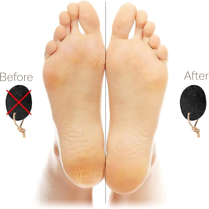 Pumice Stones for Feet - Image 6