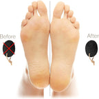 Pumice Stones for Feet - Image 6