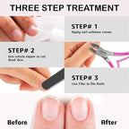 Professional Cuticle Trimmer Nail Cuticle Cutter Stainless Steel Cuticle Nippers - Image 3