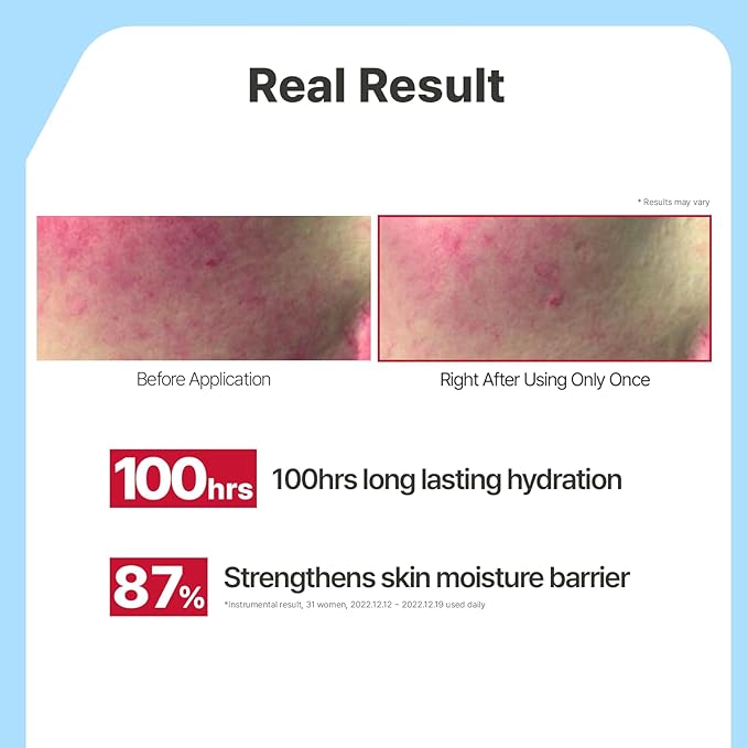 ILLIYOON Ceramide Ato Lotion 528ml | Daily Moisturizing Lotion - Image 4