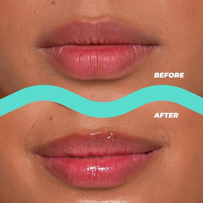 Vitamasques Lip Butter Balm - Image 2