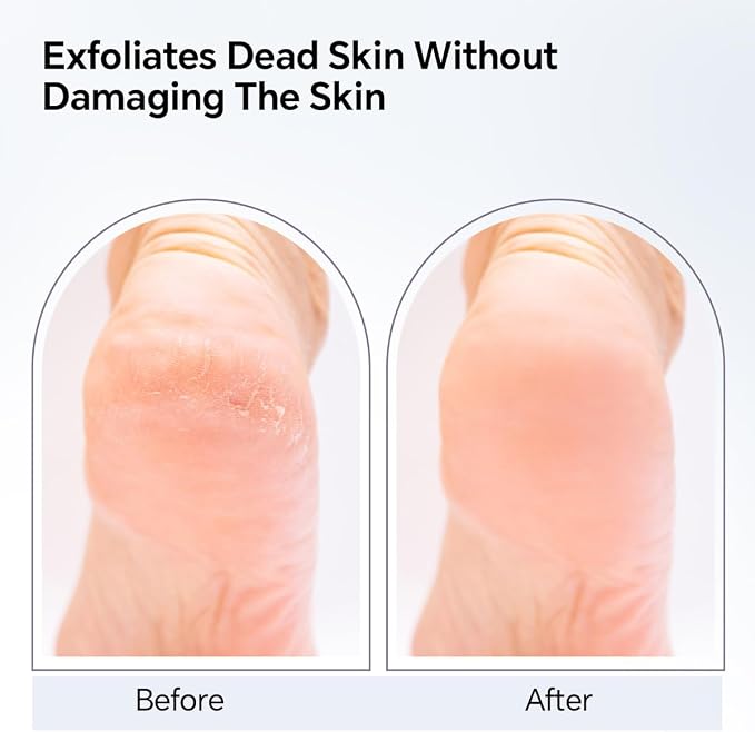 Nano Glass Foot File, Foot Callus Remover, Double Sided Pedicure Tools - Image 5