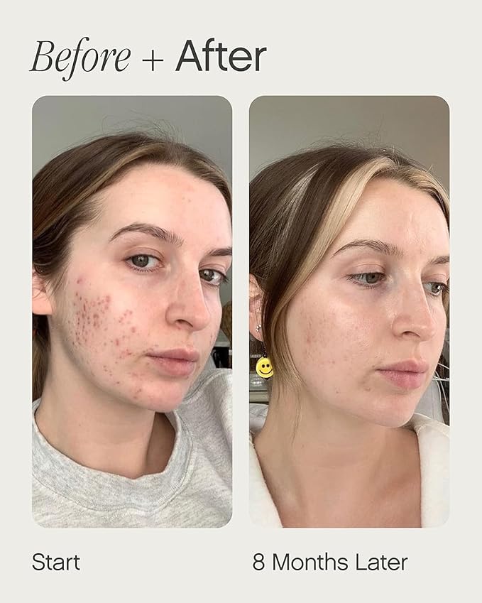 Topicals Faded Brightening and Clearing Serum | Reduces Discoloration, - Image 4