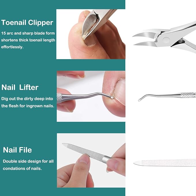 Pedicure Tools for Feet, Ingrown Toenail Treatment, Ingrown Toenail Removal Kit - Image 2