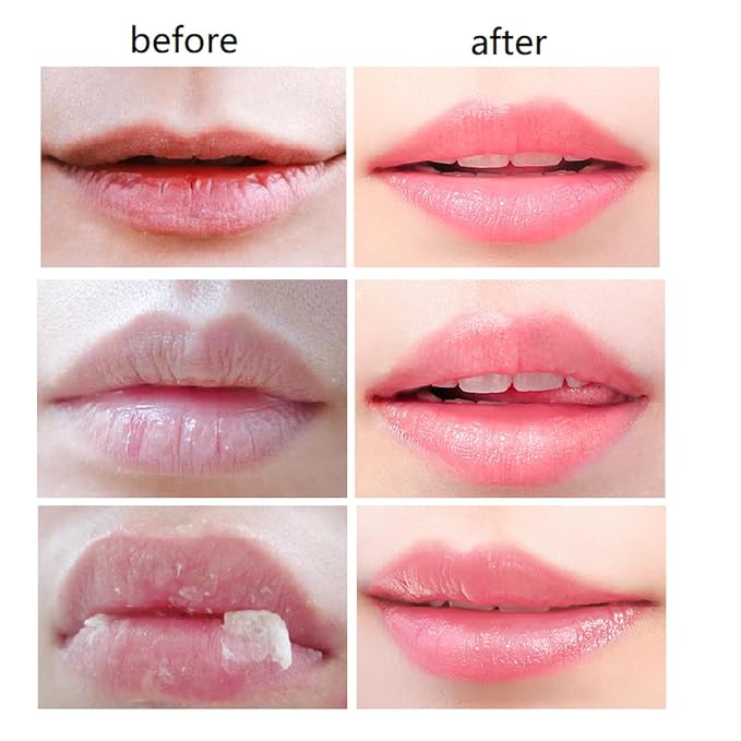 2 PCS Bee Lip Balm Honey Pot, Honey Propolis Lip Mask Moisturizing Moisture - Image 8