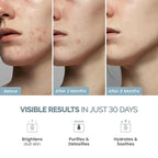 PLANTIFIQUE Korean Volcanic & Dead Sea Mud Mask - Image 2