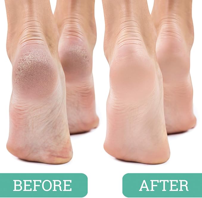 Maccibelle Salon Foot Pumice and Scrubber - Image 3