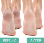 Maccibelle Salon Foot Pumice and Scrubber - Image 3