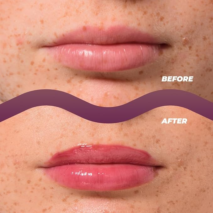 Vitamasques Lip Butter Balm - Image 2