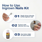 URIEL UPGRADED Ingrown Toenail Treatment - Image 5