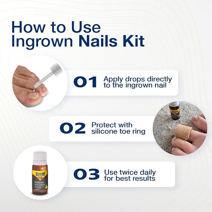 URIEL UPGRADED Ingrown Toenail Treatment - Image 5