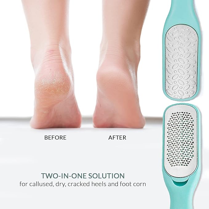 Callus & Dead Skin Remover – Dual-Sided - Image 7
