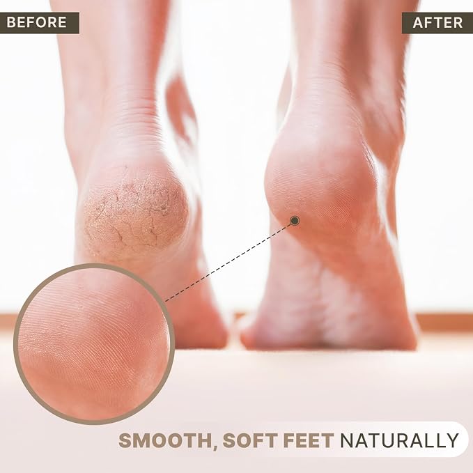 Pumice Stone for Feet - Image 4