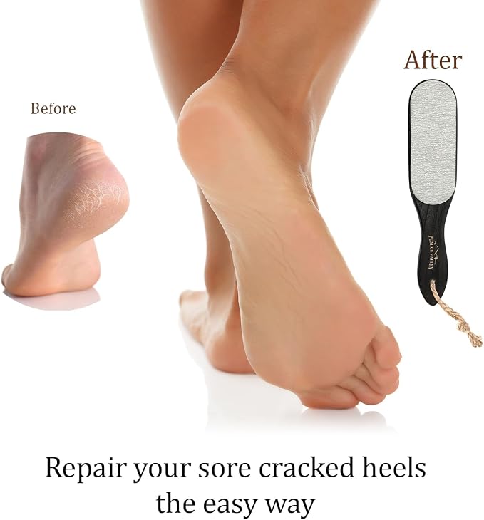 Pumice Stone Foot Scrubber - Image 5