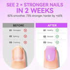 Gelike EC Nail Kit for Beginners: Purple Easy-Use Nail Polish Growth Treatment - Image 3