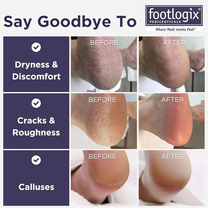 FOOTLOGIX Double Sided File - Image 2