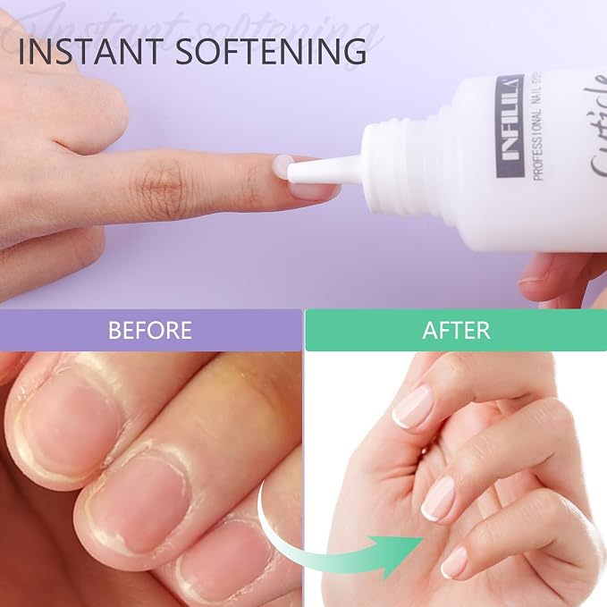 NXJ INFILILA Cuticle Softener, Instant Cuticle Remover Liquid - Image 2