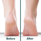 Probelle Double Sided Multidirectional Nickel Foot File Callus Remover - Image 4
