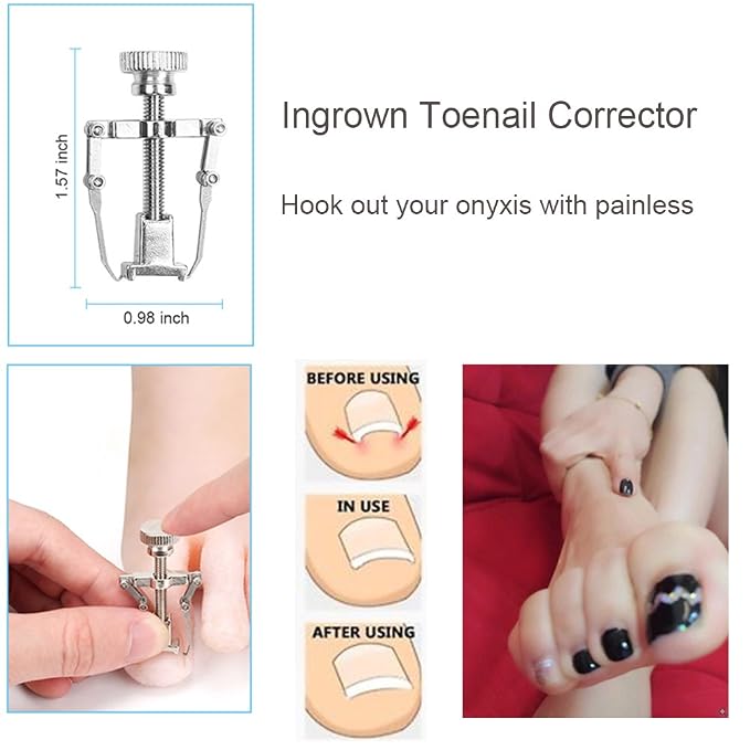 Bcabo 10Pcs/set Ingrown Toenail Tools Kit, Nail Treatment Foot Tool, Ingrown - Image 6
