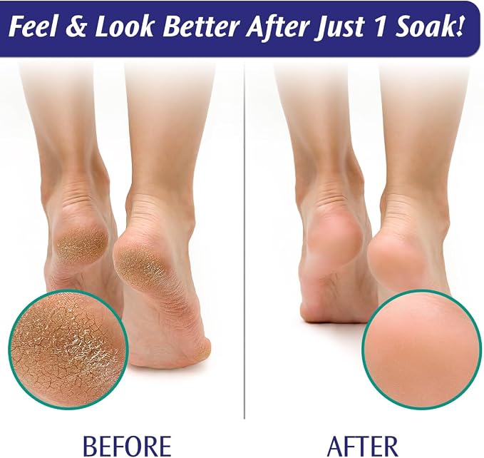 PediFix Soaking Crystals Foot Bath – 6 Packets – Therapeutic Foot Soak - Image 6
