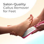 Microplane Colossal Foot File, Dead Skin/Callus Remover - Image 4