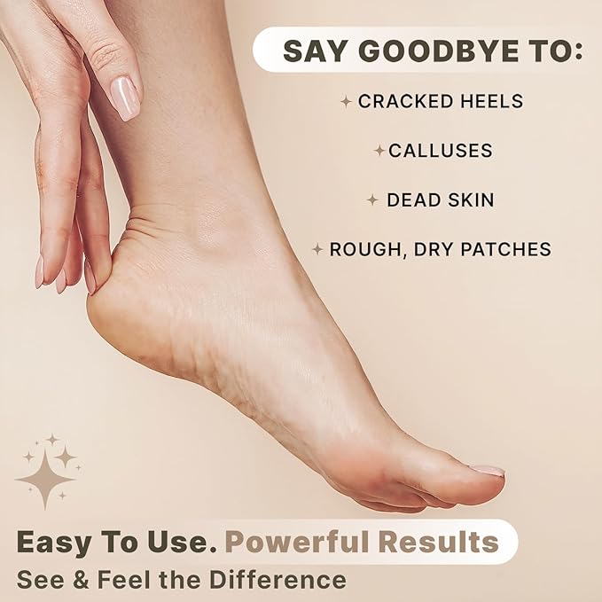 Pumice Stone for Feet - Image 3