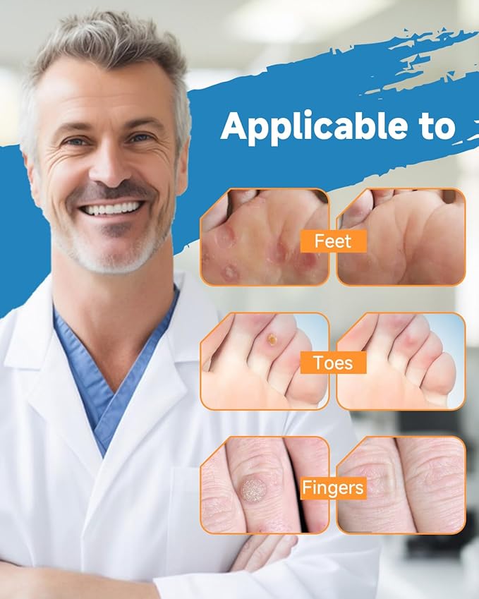 MQFORU Liquid Corn & Callus Removers - Image 5