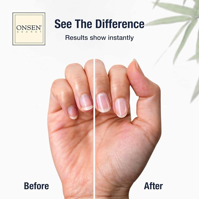 Onsen Secret Nail Care Kit - Image 2