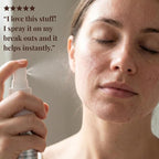 Pure Relief Rescue Spray for Sensitive, Irritated & Blemish-Prone Skin – - Image 8