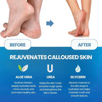 Imperial Feet Callus Remover for Feet Extra Strength Set – Callus Softener - Image 5