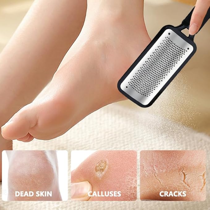Foot File Stainless Steel Foot Rasp Callus Remover Professional Scrubber - Image 2
