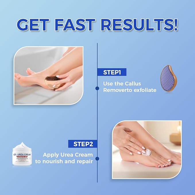 OUKEYA Urea Cream 42 Percent for Foot & Hand Cream - Image 3