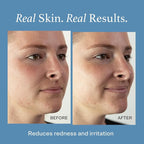 Otella Detox & Soothe Face Mist - Image 5