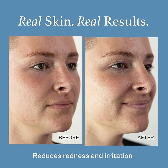 Otella Detox & Soothe Face Mist - Image 5