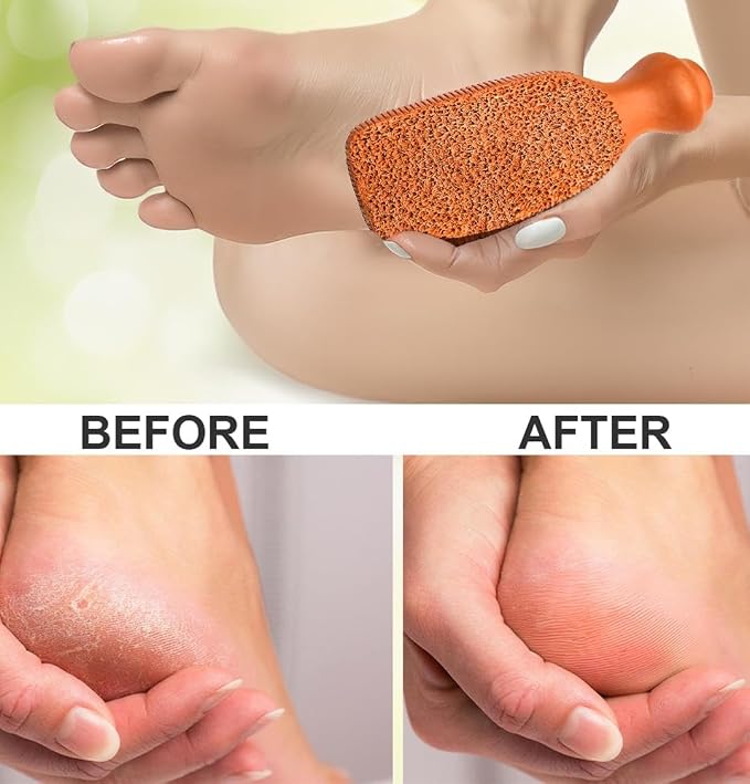 QUBA LINEN Pumice Stone for Feet – 2-Sided Terra Cotta Foot Scrubber, Natural - Image 7
