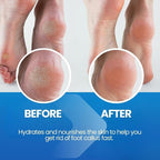 Imperial Feet Callus Softener Spray - Image 2