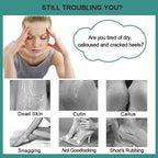 CAREHOOD Foot File Callus Remover - Image 2