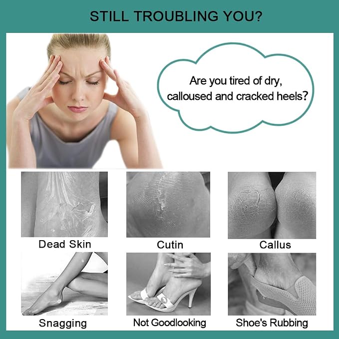 CAREHOOD Foot File Callus Remover - Image 2