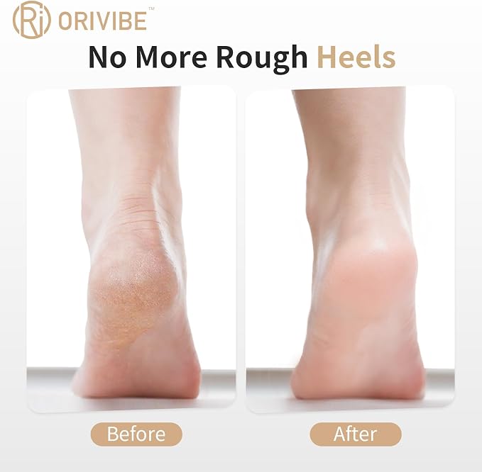 Electric Callus Remover for Feet – 2 Speeds, Fine & Coarse Rollers, USB-C - Image 2