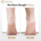 Electric Callus Remover for Feet – 2 Speeds, Fine & Coarse Rollers, USB-C - Image 2