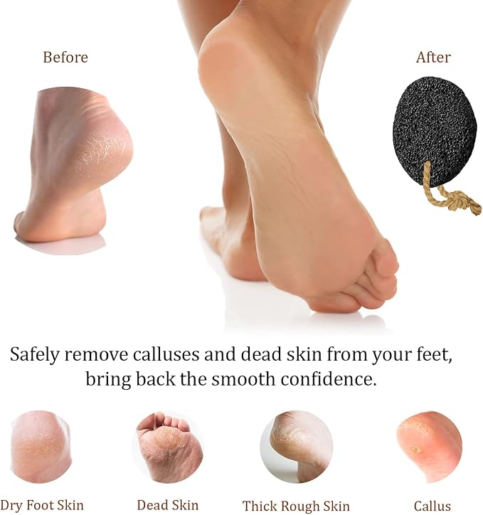 Pumice Stone - Natural Earth Lava Black - Callus/Corn Remover - Image 3