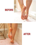 Kerasal Intensive Foot Repair Skin Healing Ointment, 1 Oz and Moisturizing Gel - Image 4