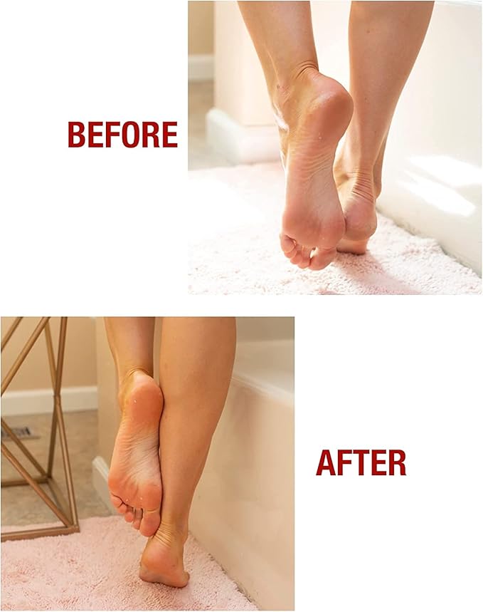 Kerasal Intensive Foot Repair Skin Healing Ointment, 1 Oz and Moisturizing Gel - Image 5