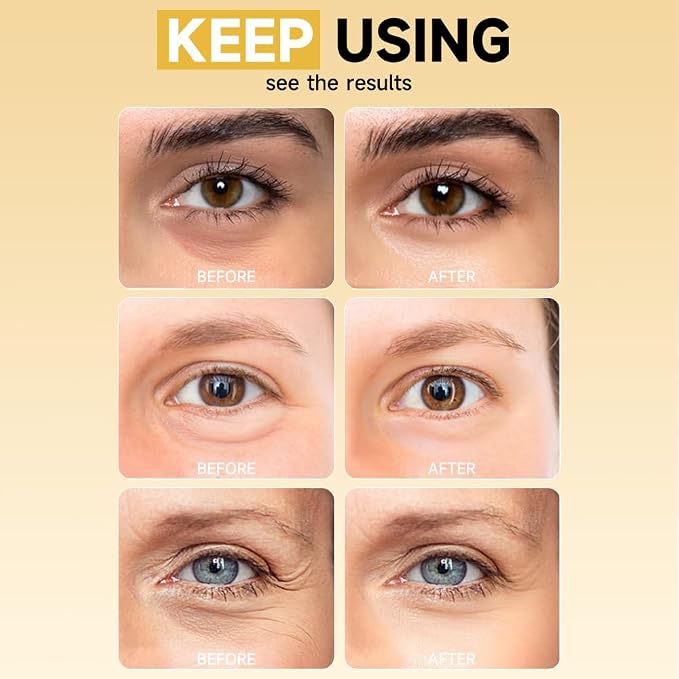 8 Pairs 5% PDRN Under Eye Patches, 6-in-1 Bio-Collagen 360° Eye Patches - Image 8