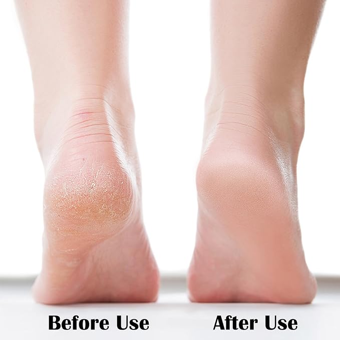 Nano Foot File, Foot Scrubber Callus Remover, Foot Care Pedicure Tool, Foot File - Image 3