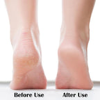 Nano Foot File, Foot Scrubber Callus Remover, Foot Care Pedicure Tool, Foot File - Image 3