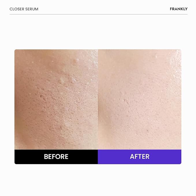 FRANKLY Closer Serum | Pore Minimizer Serum | 9 Peptides, Vegan Collagen - Image 2