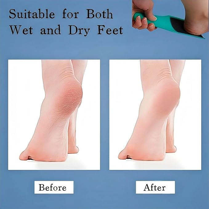 U-Shaped Curved Foot File, Double-Sided Dead Skin Callus Remover, Foot Scrubber - Image 7