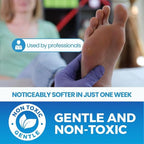 Imperial Feet Callus Softener Spray - Image 4